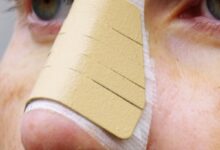 بینی عروسکی به چه فرم صورتی می‌آید؟