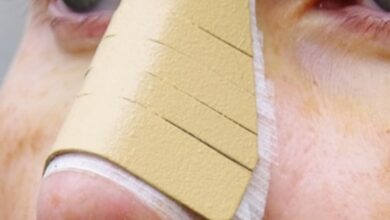 بینی عروسکی به چه فرم صورتی می‌آید؟