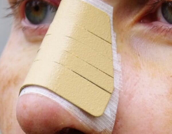 بینی عروسکی به چه فرم صورتی می‌آید؟