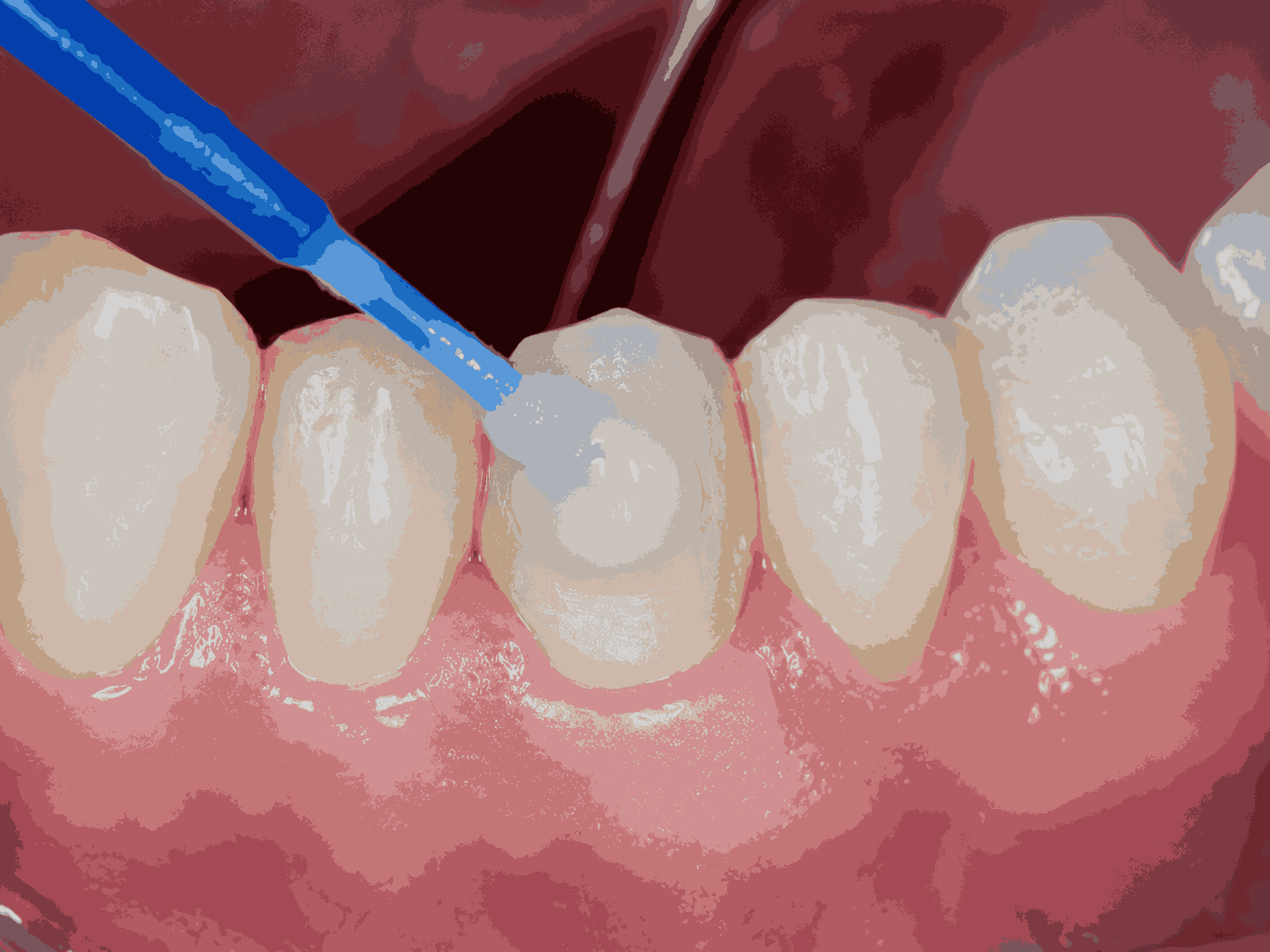 مطب دندانپزشکی مجهز با یونیت و تجهیزات دندانپزشکی